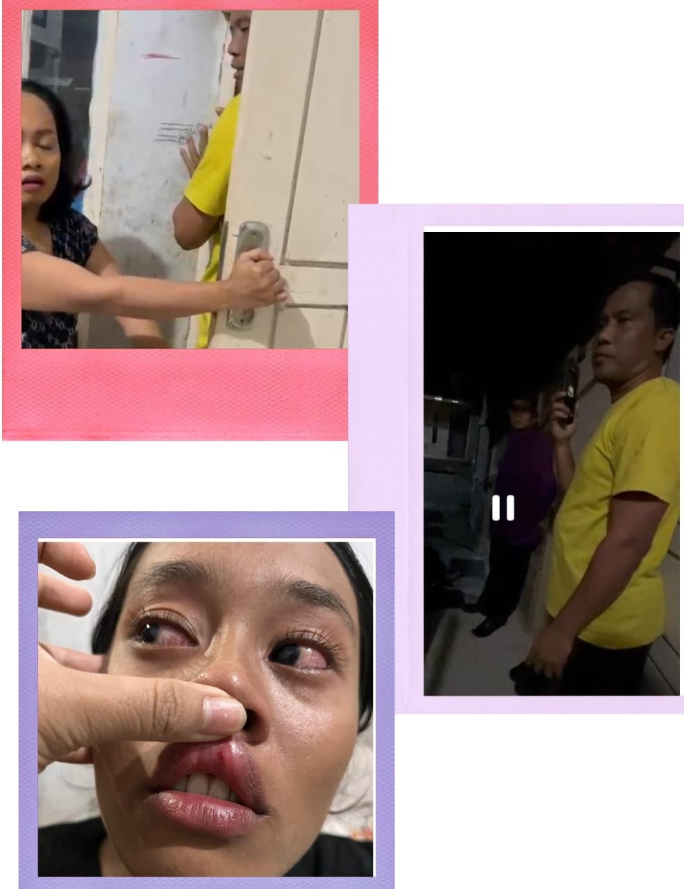 Anggota Akpersi Kampar, Dina Puspita Sari Diduga Dibanting Orang Tak Dikenal